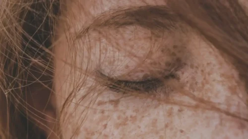 Kai kremas nepadeda – oda vis tiek šerpetoja dėl gilesnių priežasčių